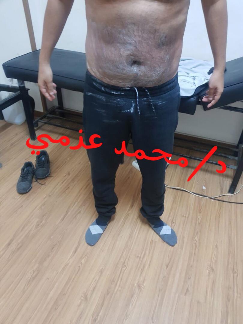 After Transformation