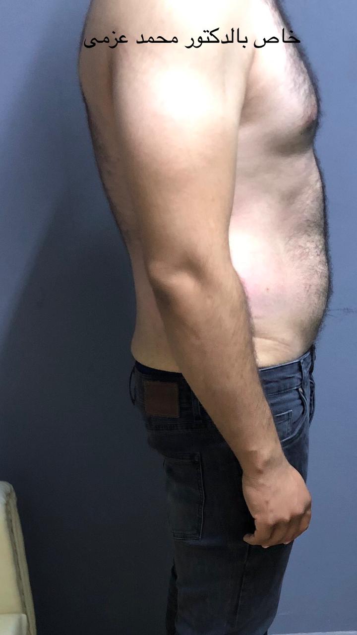 After Transformation