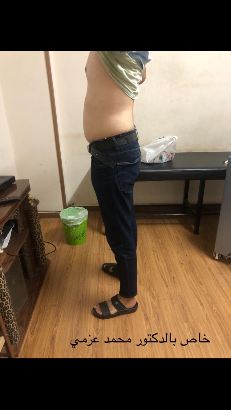 After Transformation