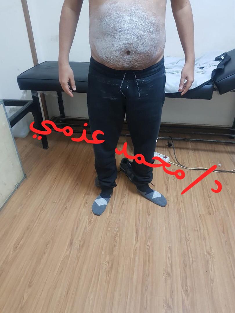 Before Transformation