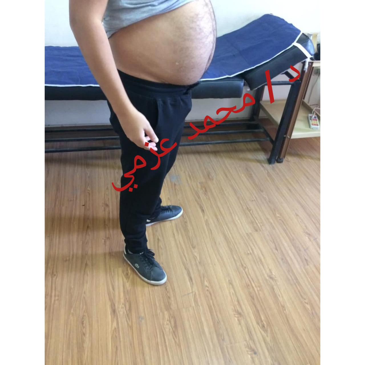 Before Transformation