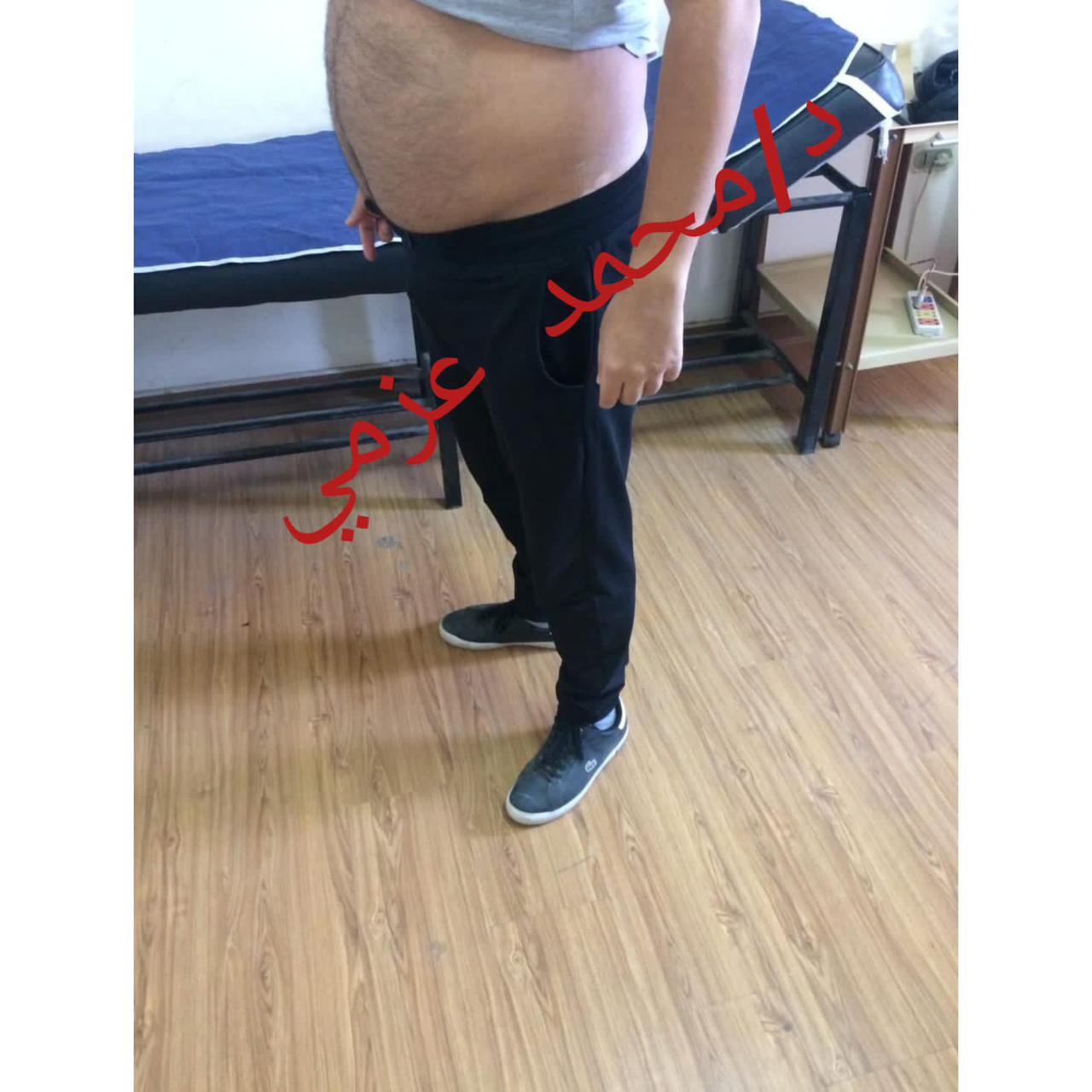 Before Transformation