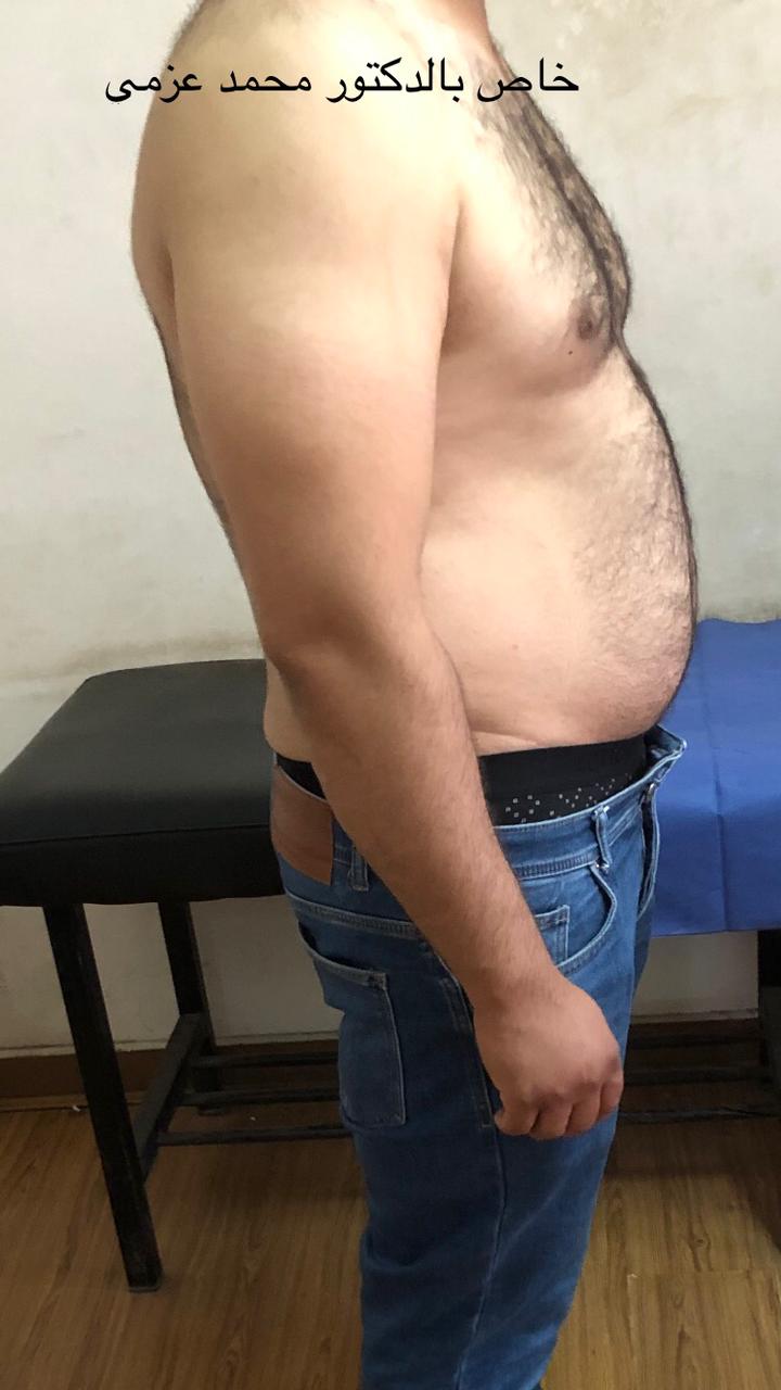 Before Transformation