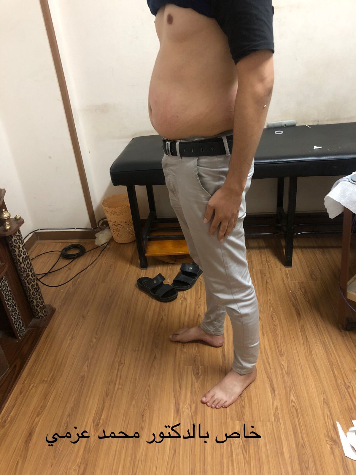 Before Transformation